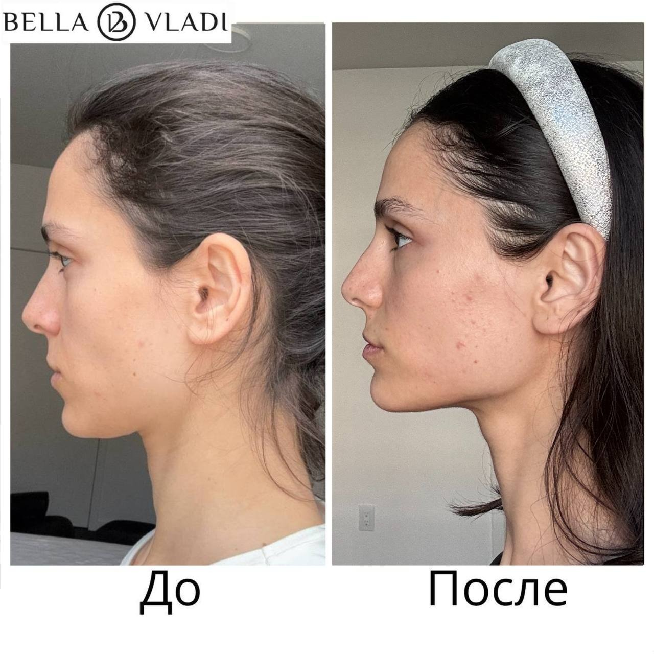 Результат ученицы Беллы Влади до и после практики ФейсФитнес, профиль