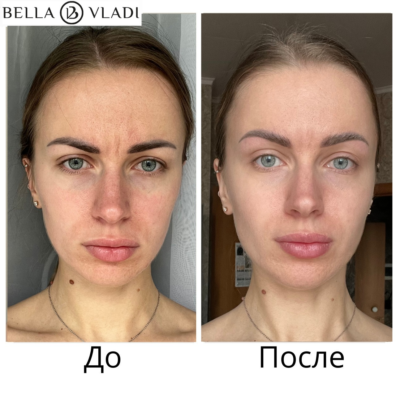 Результат ученицы Беллы Влади до и после практики ФейсФитнес, анфас и осанка